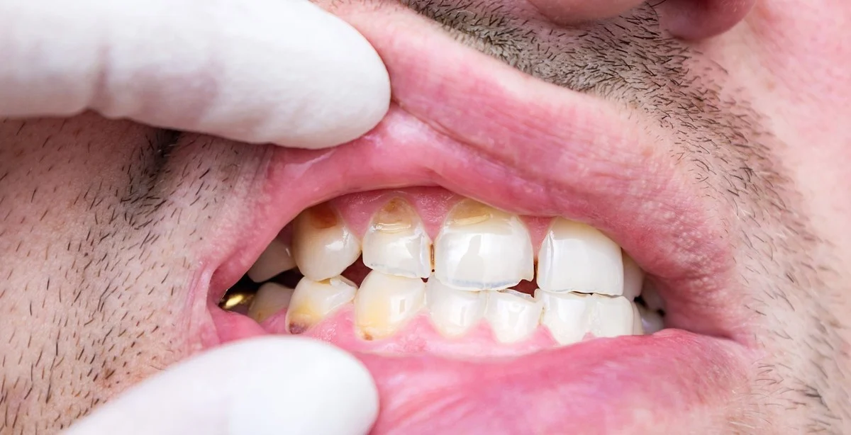 Dentisté přiznávají: tenhle ranní zvyk ničí vaše zuby víc než cokoli jiného. - image 1