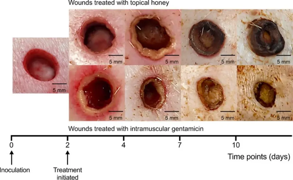 Obyčejný med v lékárničce? Zajímavý fakt o přírodním antibiotiku ve vaší kuchyni.
